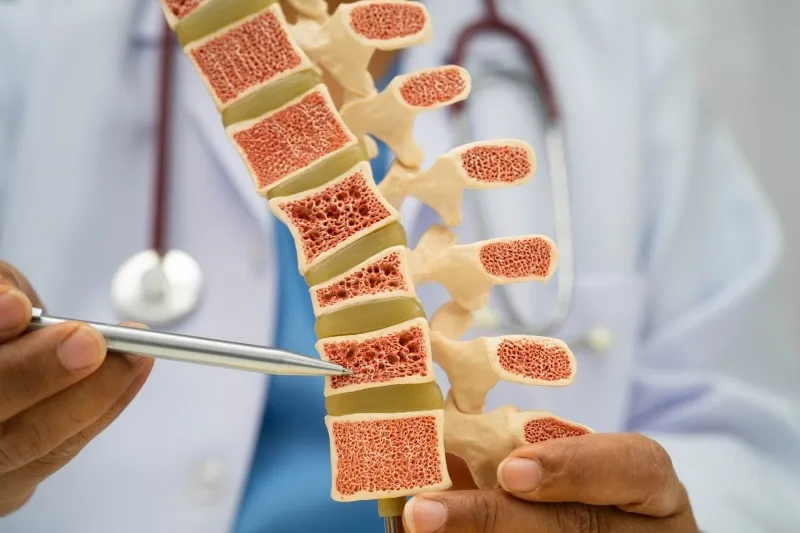 DEXAによる骨密度検査とは?骨粗鬆症を早く見つけるために大切な検査です